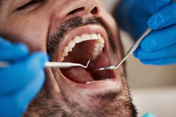 Best Emergency Treatment for Toothache in Maeser, UT