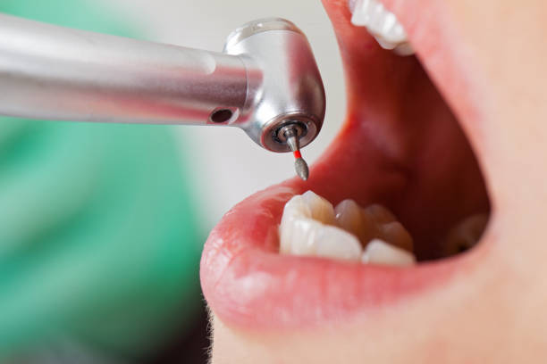 Best Emergency Treatment for Toothache in Maeser, UT
